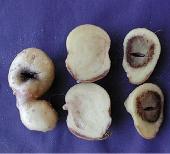 calcium deficiency internal browning potato